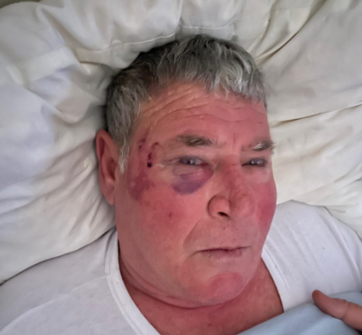 Consigliere pestato a Scafati, spunta il video del raid