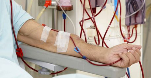 Dialisi fatale per un 66enne, un medico sotto inchiesta